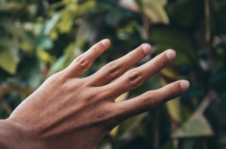 Penyebab, Diagnosis, Pengobatan, dan Pencegahan Garis Vertikal Hitam pada Kuku
